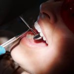 Top reasons why you should visit an orthodontist