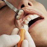 Things to know when getting the best dental care